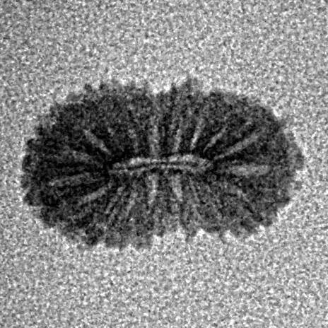 19 Mukhi Rudraksha 13.3mm 0.31gm - Inverse xray