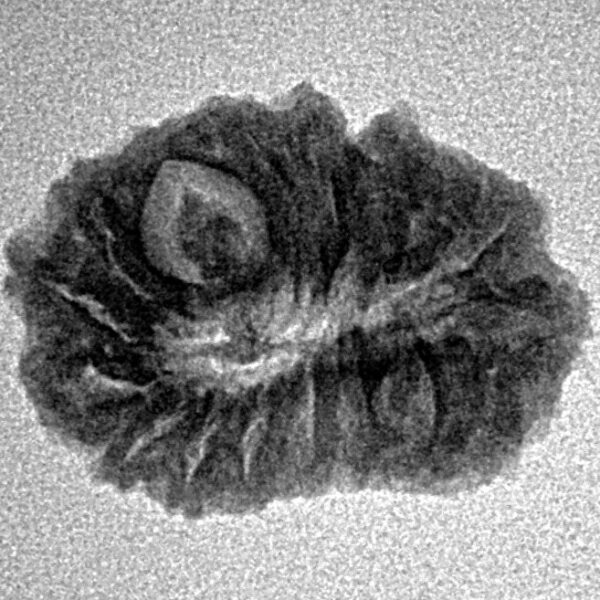 18 Mukhi Rudraksha 20.9mm 1.81gm - Inverse xray