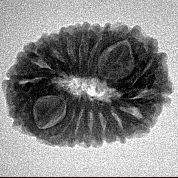 17 Mukhi Rudraksha 22.3mm 2.74gm - Inverse xray