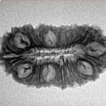 25 Mukhi Rudraksha 27.3mm 2.54gm - Inverse xray