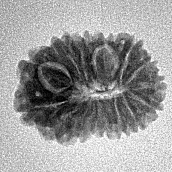 15 Mukhi Rudraksha 19.2mm 1.44gm - Inverse xray