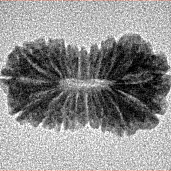 17 Mukhi Rudraksha 18.3mm 0.94gm - Inverse xray