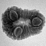 16 Mukhi Rudraksha 20.7mm 2.13gm - Inverse xray