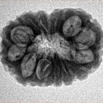 16 Mukhi Rudraksha 20.5mm 2.06gm - Inverse xray