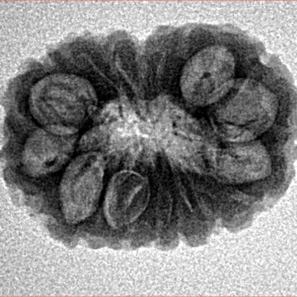 16 Mukhi Rudraksha 20.5mm 2.06gm - Inverse xray