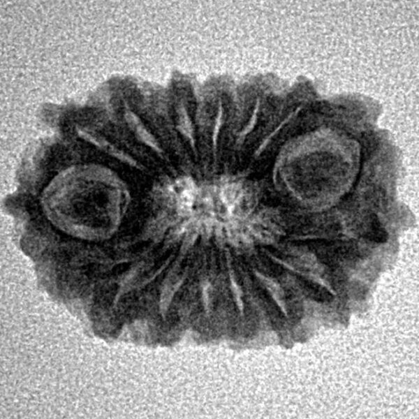 16 Mukhi Rudraksha 20.9mm 1.82gm - Inverse xray