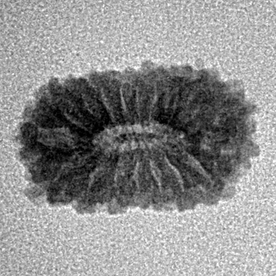 17 Mukhi Rudraksha 16.5mm 0.92gm - Inverse xray