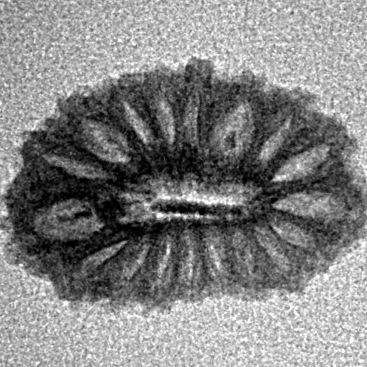 18 Mukhi Rudraksha 17.7mm 0.75gm - Inverse xray