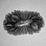 17 Mukhi Rudraksha 21.2mm 1.64gm - Inverse xray