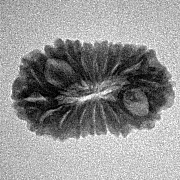 17 Mukhi Rudraksha 21.2mm 1.64gm - Inverse xray