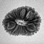 15 Mukhi Rudraksha 19.3mm 1.84gm - Inverse xray