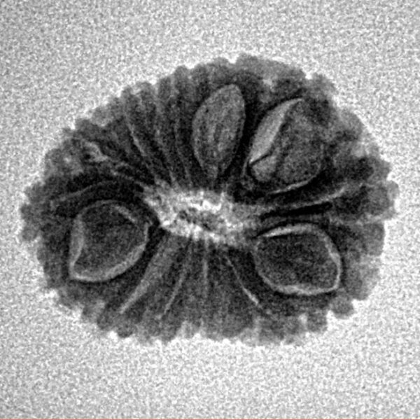 15 Mukhi Rudraksha 19.3mm 1.84gm - Inverse xray