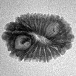 16 Mukhi Rudraksha 20.4mm 1.69gm - Origin: Indonesia - Inverse xray