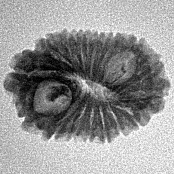 16 Mukhi Rudraksha 20.4mm 1.69gm - Origin: Indonesia - Inverse xray