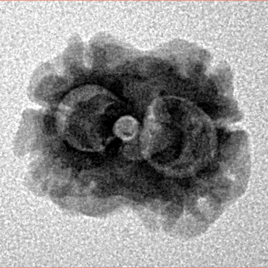 2 Mukhi Rudraksha 17.8mm 1.48gm - Origin: Nepal - Inverse xray