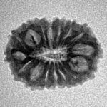 16 Mukhi Rudraksha 18.2mm 1.23gm - Inverse xray