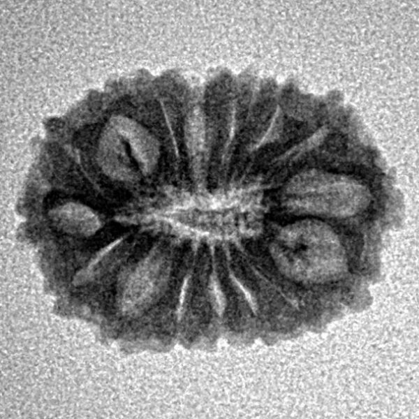 16 Mukhi Rudraksha 18.2mm 1.23gm - Inverse xray