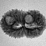 18 Mukhi Rudraksha 20.4mm 1.42gm - Inverse xray