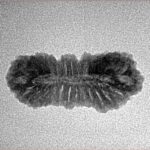 27 Mukhi Rudraksha 23.8mm 1.39gm - Inverse xray