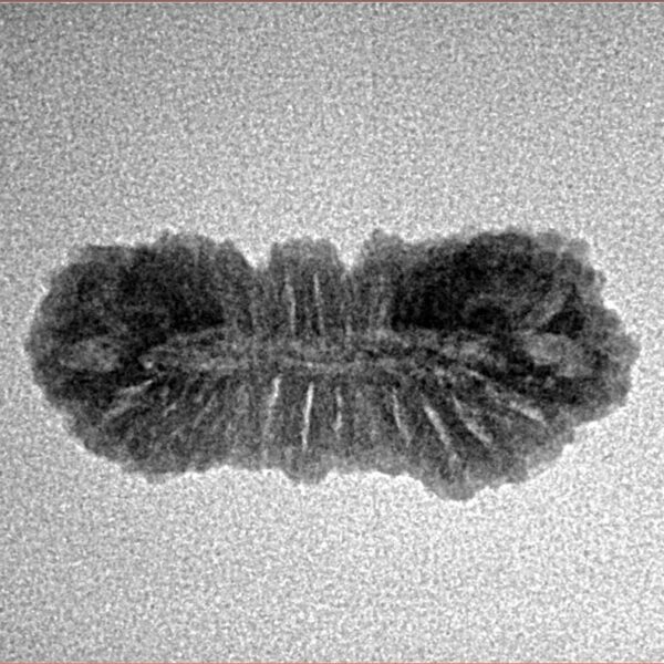 27 Mukhi Rudraksha 23.8mm 1.39gm - Inverse xray