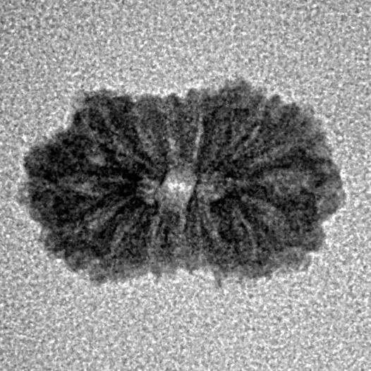 16 Mukhi Rudraksha 15.1mm 0.61gm - Inverse xray