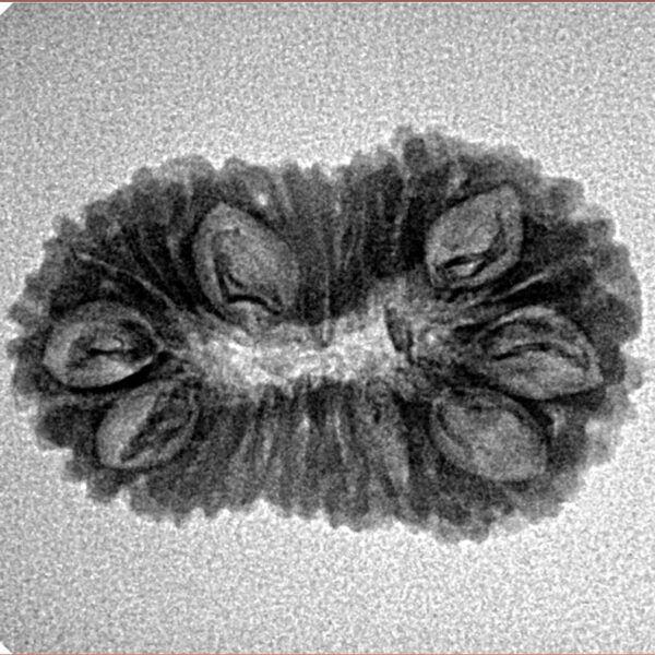 19 Mukhi Rudraksha 24.9mm 2.36gm - Inverse xray