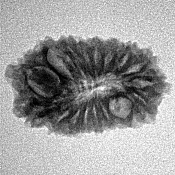 17 Mukhi Rudraksha 22mm 1.79gm - Inverse xray