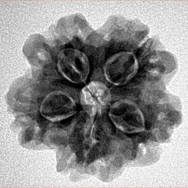 1MK(Underdeveloped) 23.4mm 4.07gm - Inverse xray