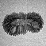 25 Mukhi Rudraksha 21.4mm 1.06gm - Inverse xray