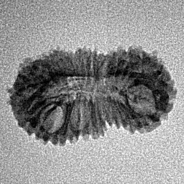 25 Mukhi Rudraksha 21.4mm 1.06gm - Inverse xray