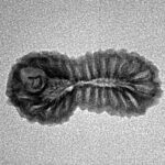 26 Mukhi Rudraksha 22.2mm 1.14gm - Inverse xray