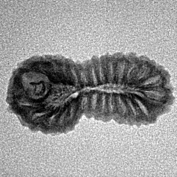 26 Mukhi Rudraksha 22.2mm 1.14gm - Inverse xray
