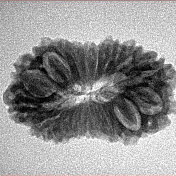 16 Mukhi Rudraksha 25.4mm 2.59gm - Inverse xray