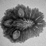 16 Mukhi Rudraksha 23.2mm 1.9gm - Inverse xray