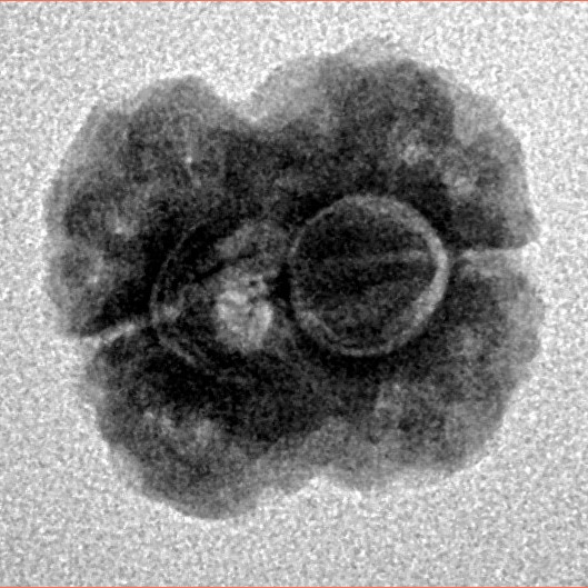 2 Mukhi Rudraksha 17.4mm 1.74gm - Inverse xray