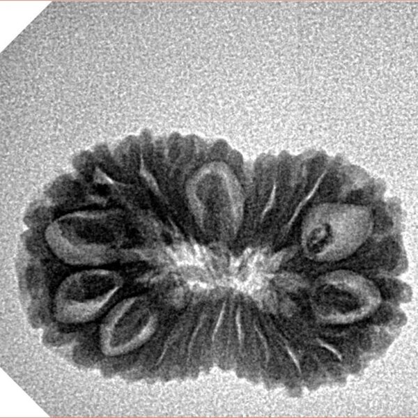 19 Mukhi Rudraksha 23.9mm 2.39gm - Inverse xray