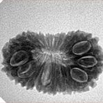 20 Mukhi Rudraksha 24.8mm 2.77gm - Inverse xray