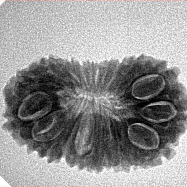 20 Mukhi Rudraksha 24.8mm 2.77gm - Inverse xray