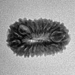 20 Mukhi Rudraksha 20.1mm 1.41gm - Inverse xray