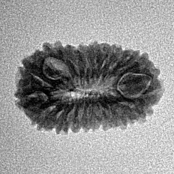 20 Mukhi Rudraksha 20.1mm 1.41gm - Inverse xray