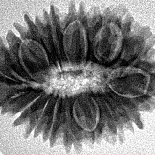19 Mukhi Rudraksha 26mm 3.65gm - Inverse xray