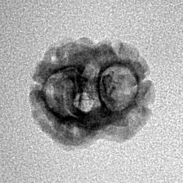 2 Mukhi Rudraksha 18.1mm 0.85gm - Inverse xray