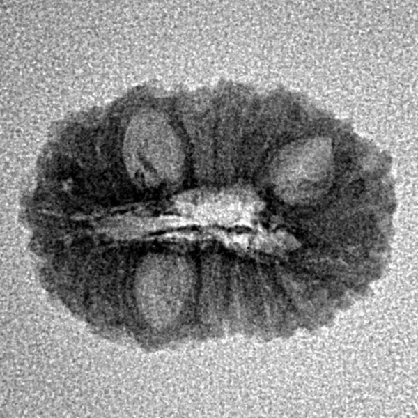 16 Mukhi Rudraksha 19.2mm 1gm - Inverse xray