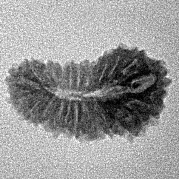 21 Mukhi Rudraksha 19.8mm 1.08gm - Inverse xray