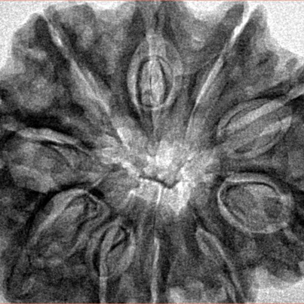 10 Mukhi Rudraksha 33.3mm 6.79gm - Inverse xray