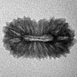 18 Mukhi Rudraksha 19.1mm 1gm - Inverse xray