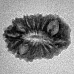 16 Mukhi Rudraksha 18.3mm 1gm - Inverse xray