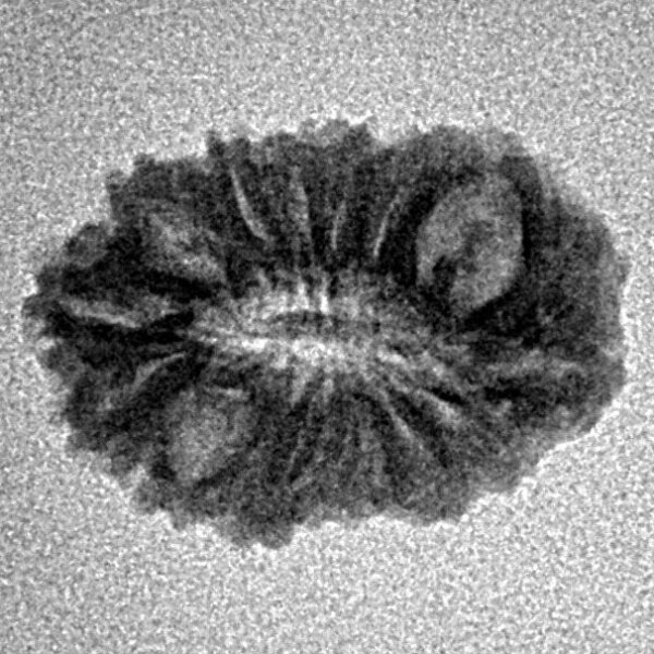 16 Mukhi Rudraksha 18.3mm 1gm - Inverse xray