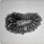 20 Mukhi Rudraksha 22.4mm 2gm - Inverse xray