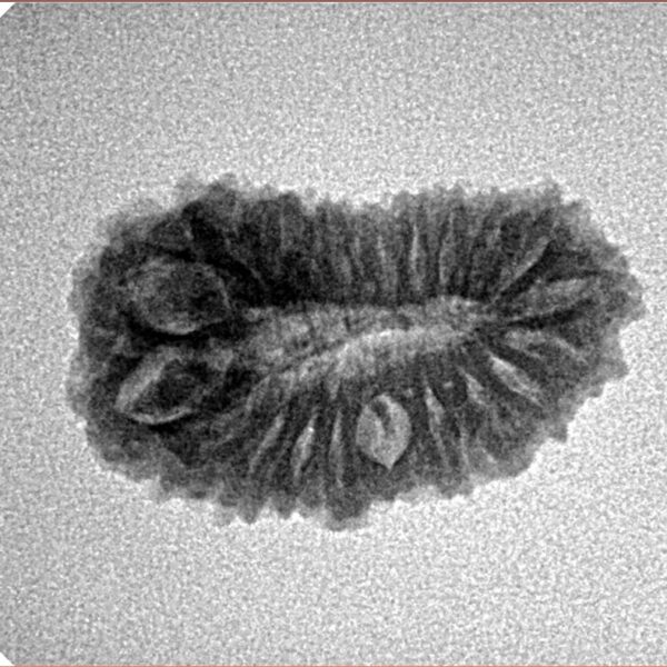 20 Mukhi Rudraksha 22.4mm 2gm - Inverse xray